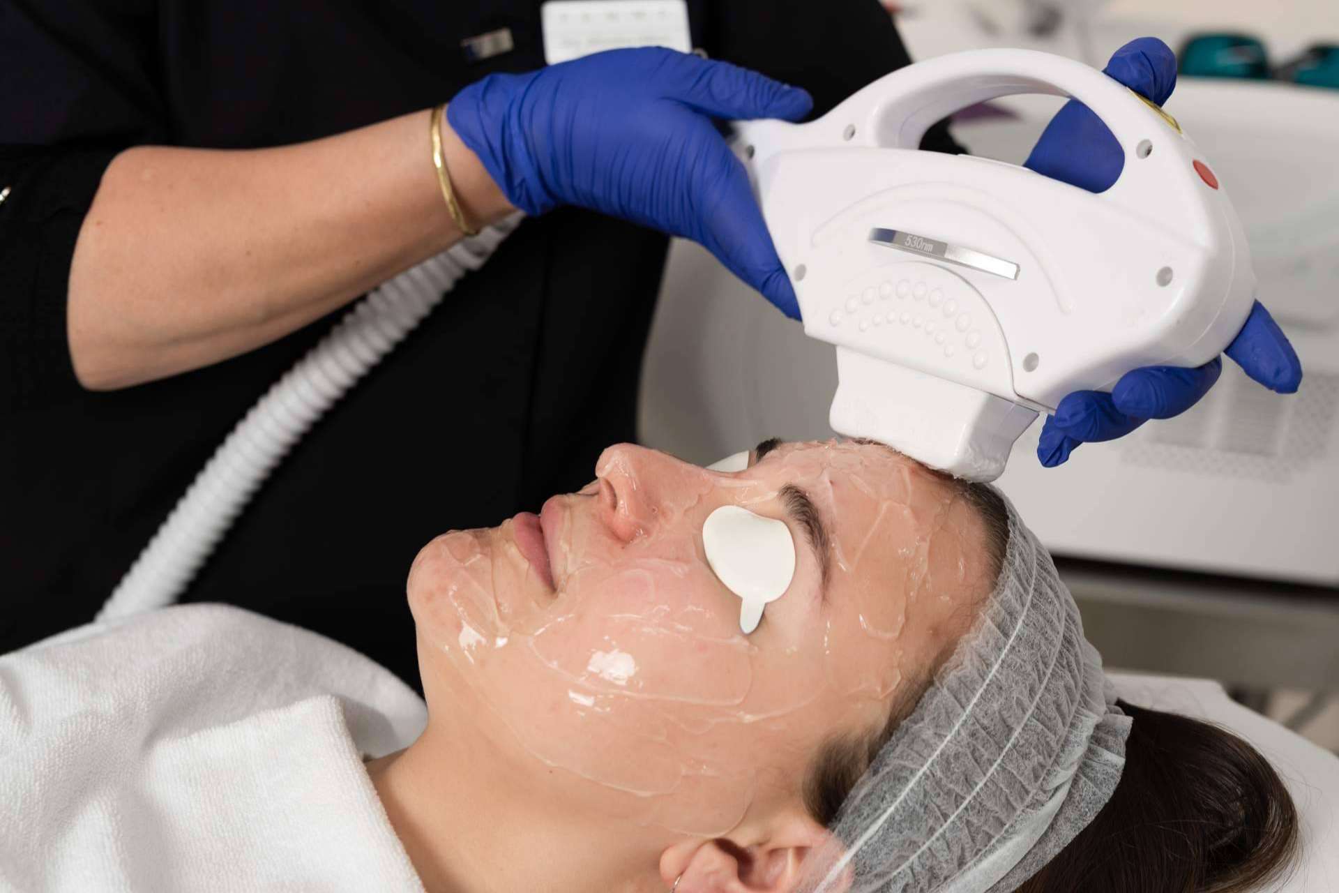 Clínica Femme ofrece el tratamiento de luz pulsada para eliminar las manchas solares de la cara, cuello y escote