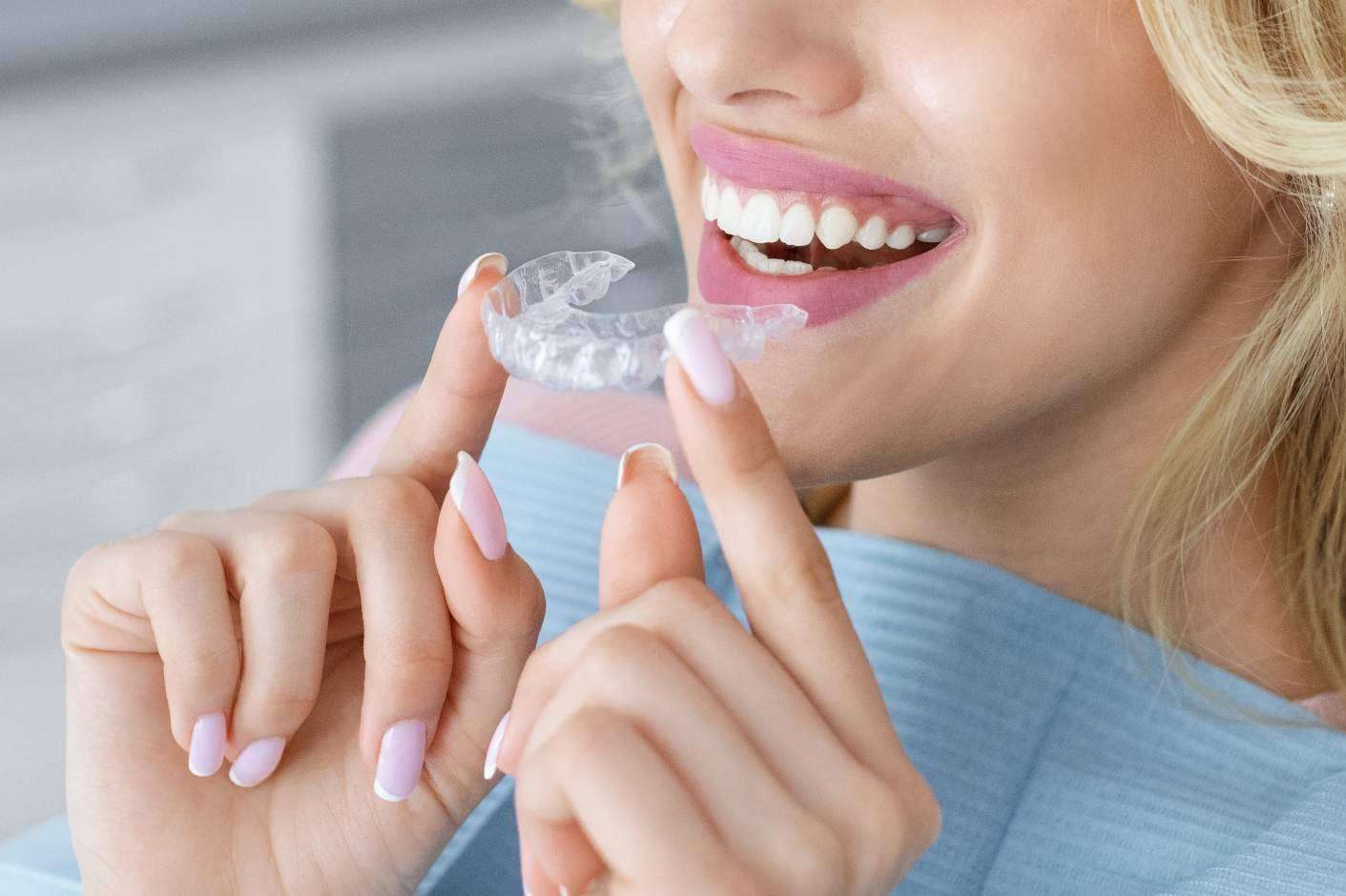 Ortodoncia invisible en Valencia, con los servicios de la Clínica Dental Bucalia