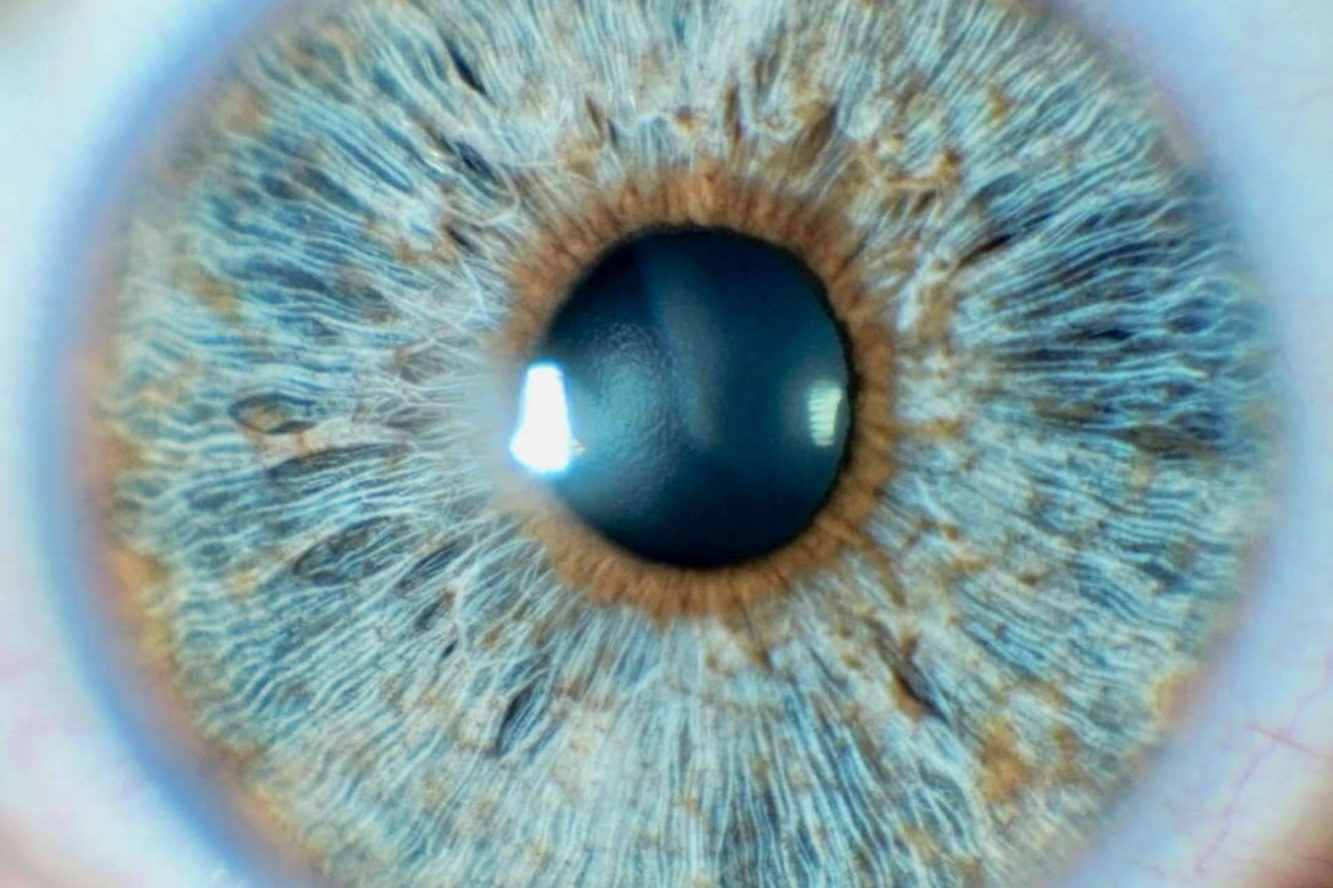 Las ventajas de la tecnología láser para cambiar el color de ojos