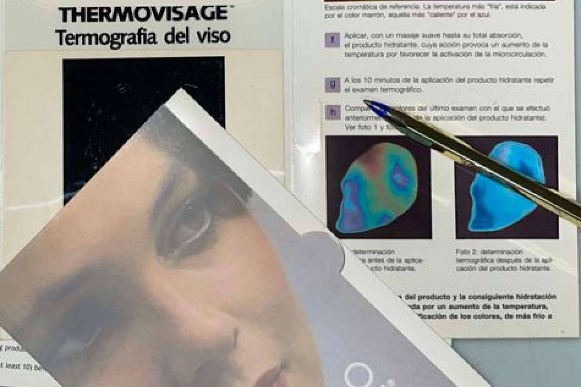 ¿En qué consiste el funcionamiento de las placas de hidratación Thermovisage?