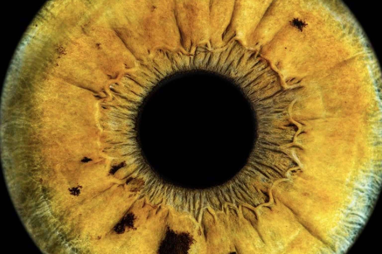 Nueva técnica fotográfica de alta definición del iris, con Eyecos