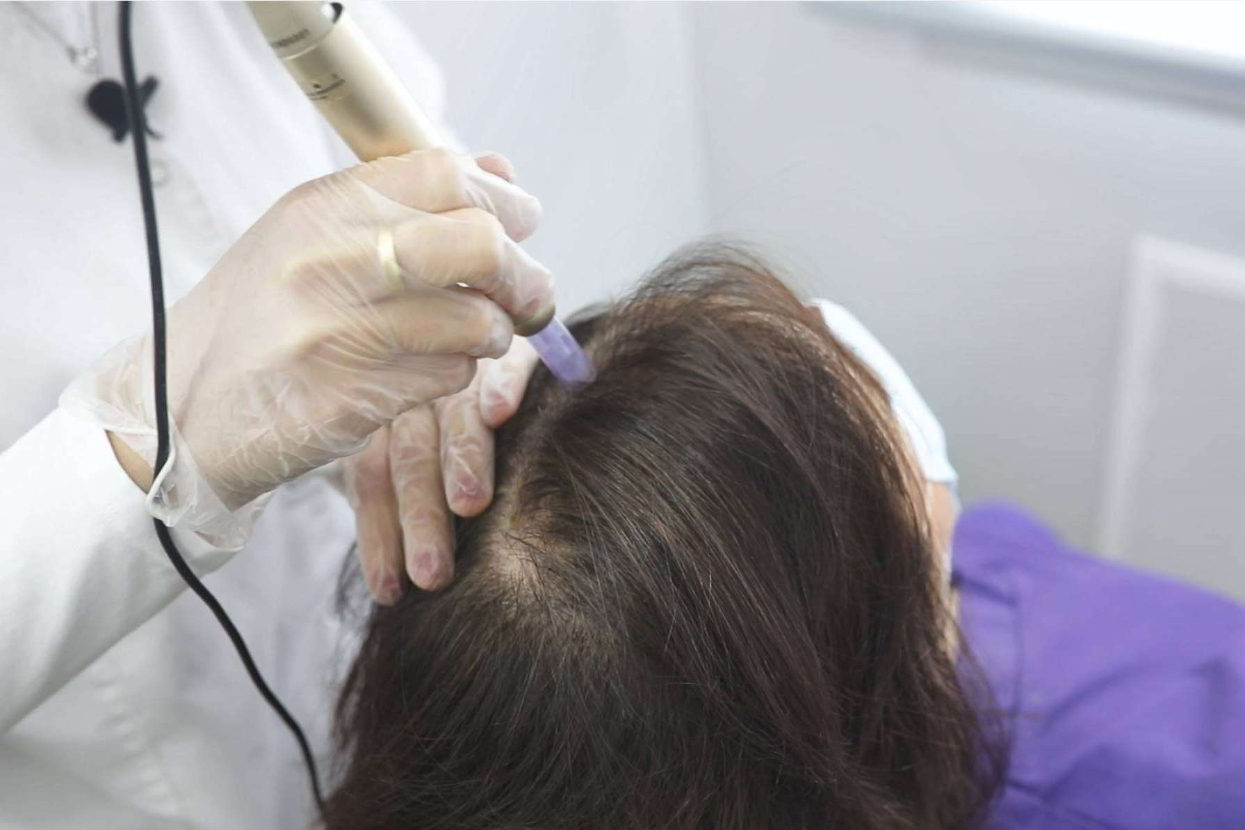Tratar la alopecia femenina con el tratamiento bioestimulación de IMD Instituto Médico Dermatológico