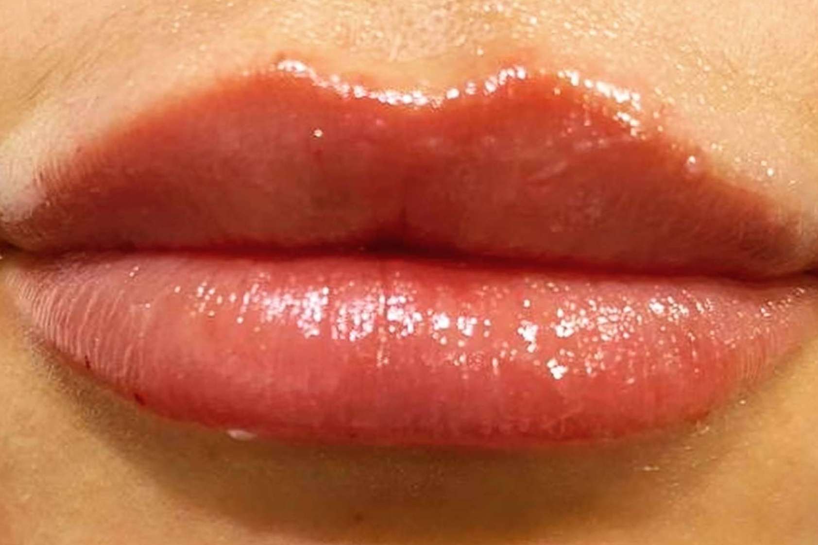 Clínica Amalfi ofrece un tratamiento facial completo para mejorar el aspecto de la piel
