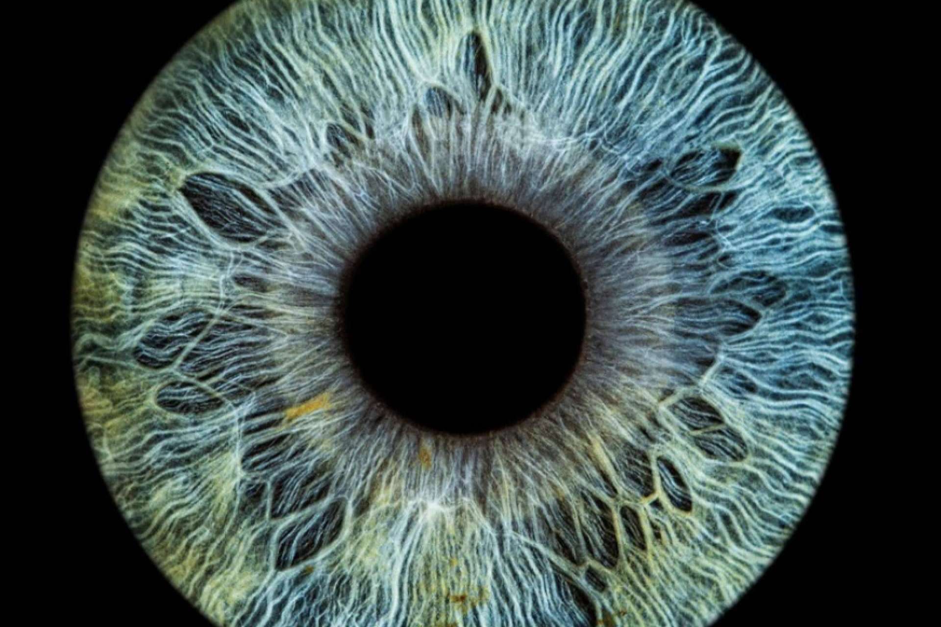 Cómo es el perfil psicológico sano de los pacientes que realizan láser de cambio de color de ojos