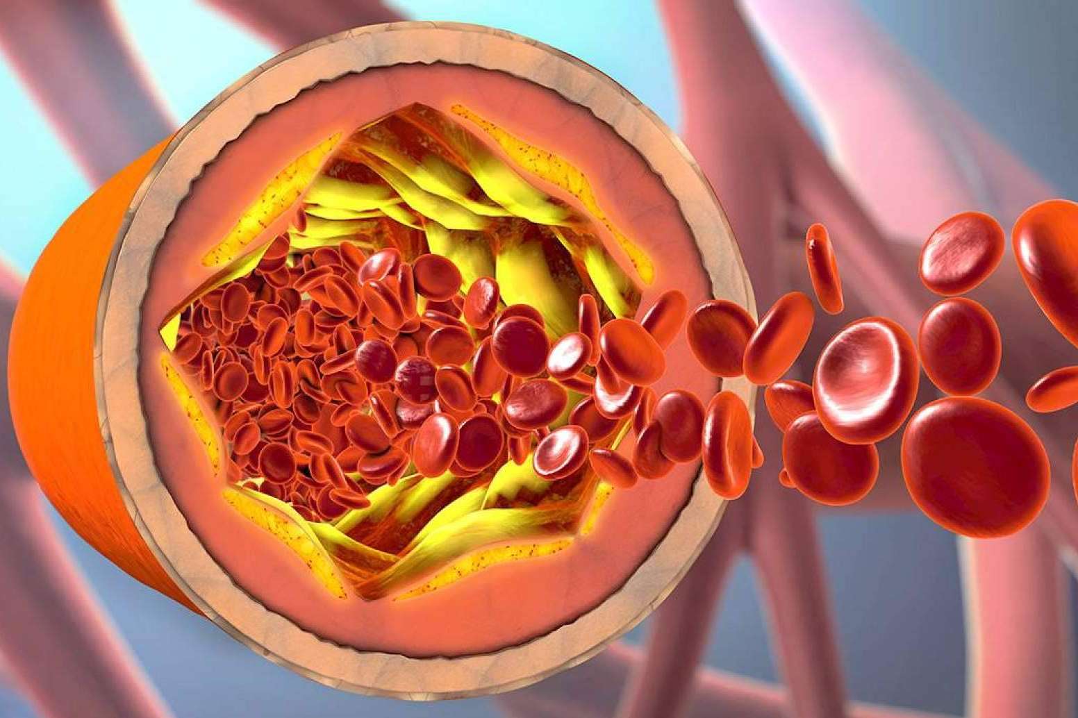 La fórmula innovadora con levadura roja de arroz rojo de Beverly Nutrition, ReduCol 25