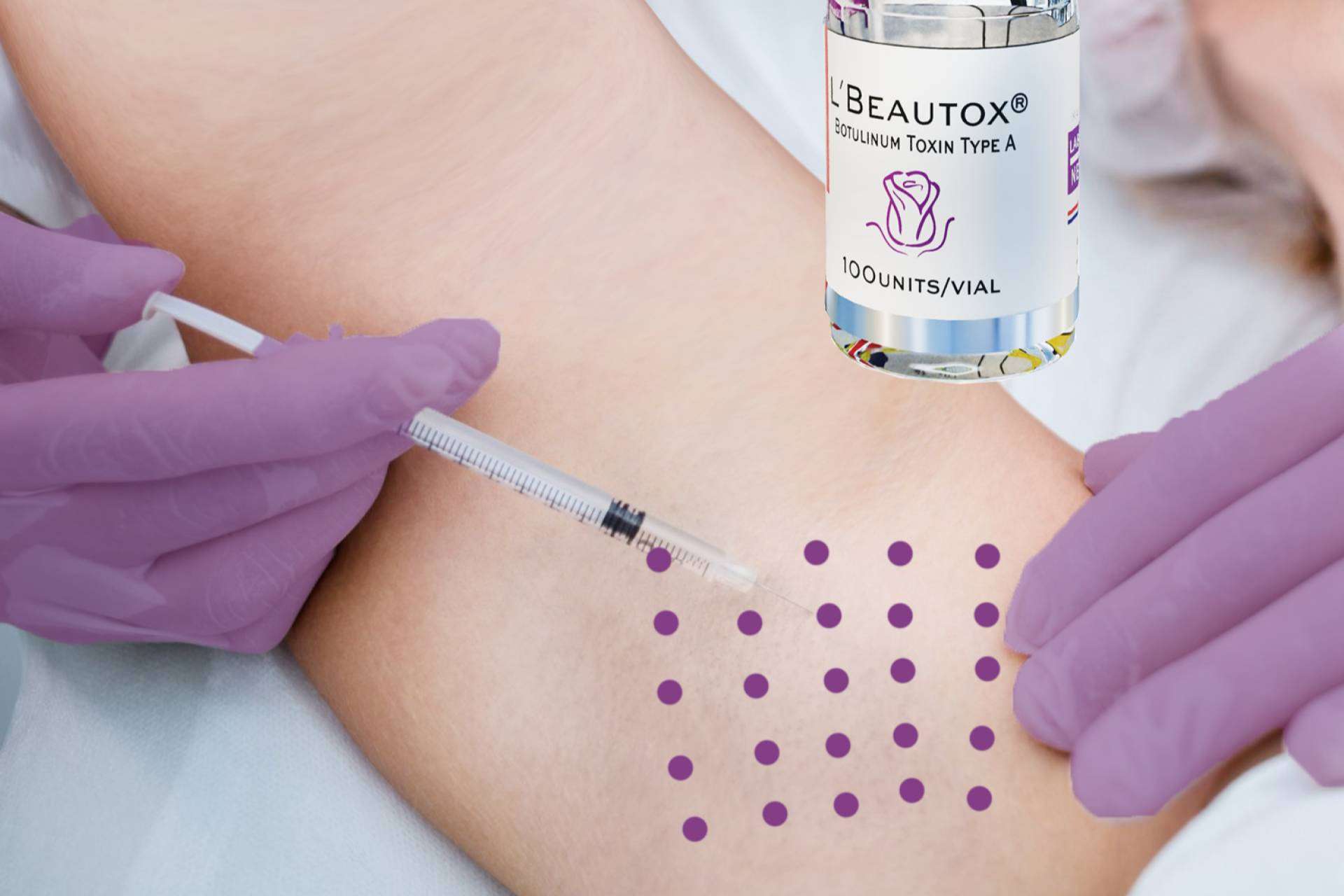 Un avance efectivo en el tratamiento de la hiperhidrosis, Toxina Botulínica LBEAUTOX