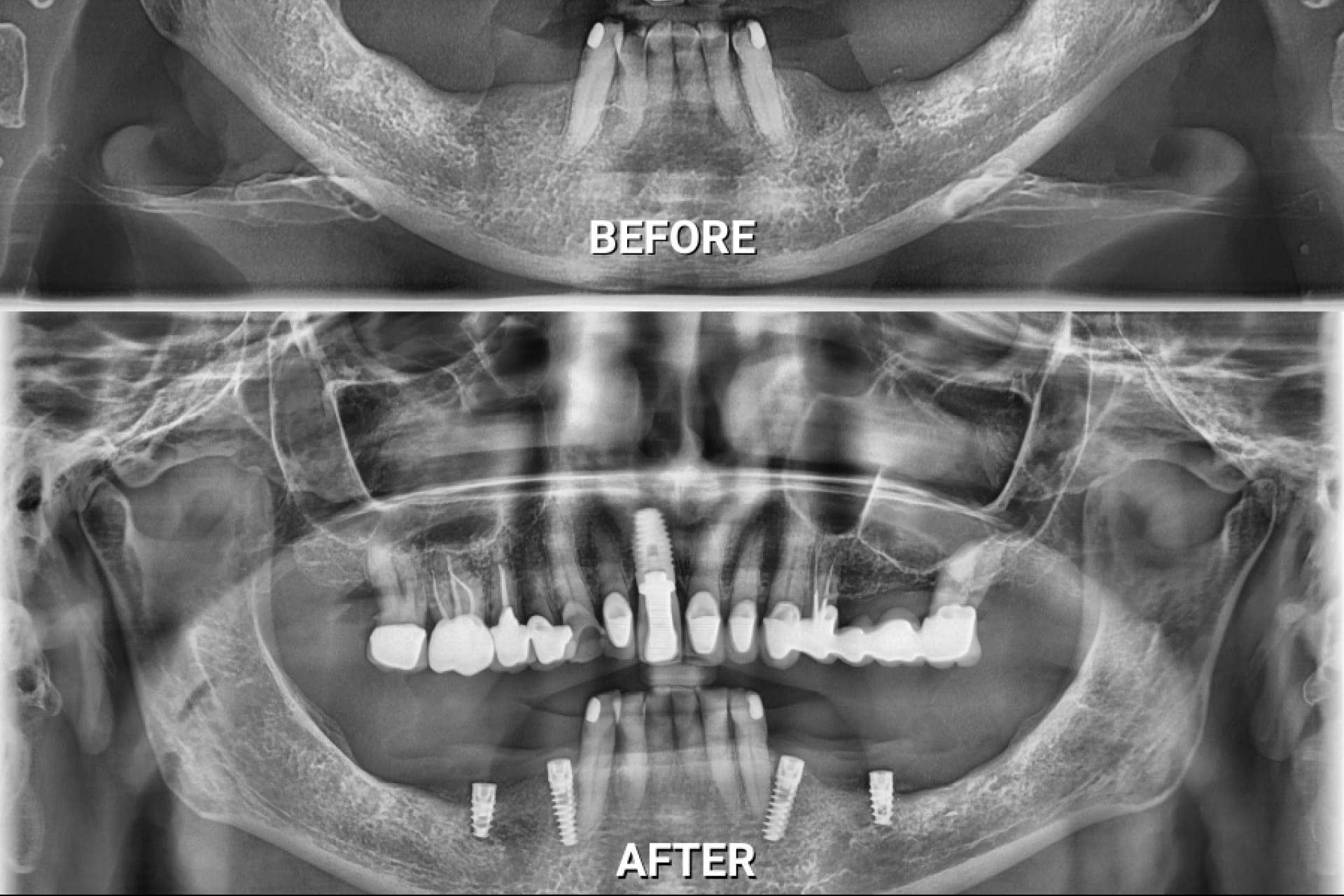 La creciente tendencia hacia la odontología integral, biológica y regenerativa en Puerto Vallarta, México