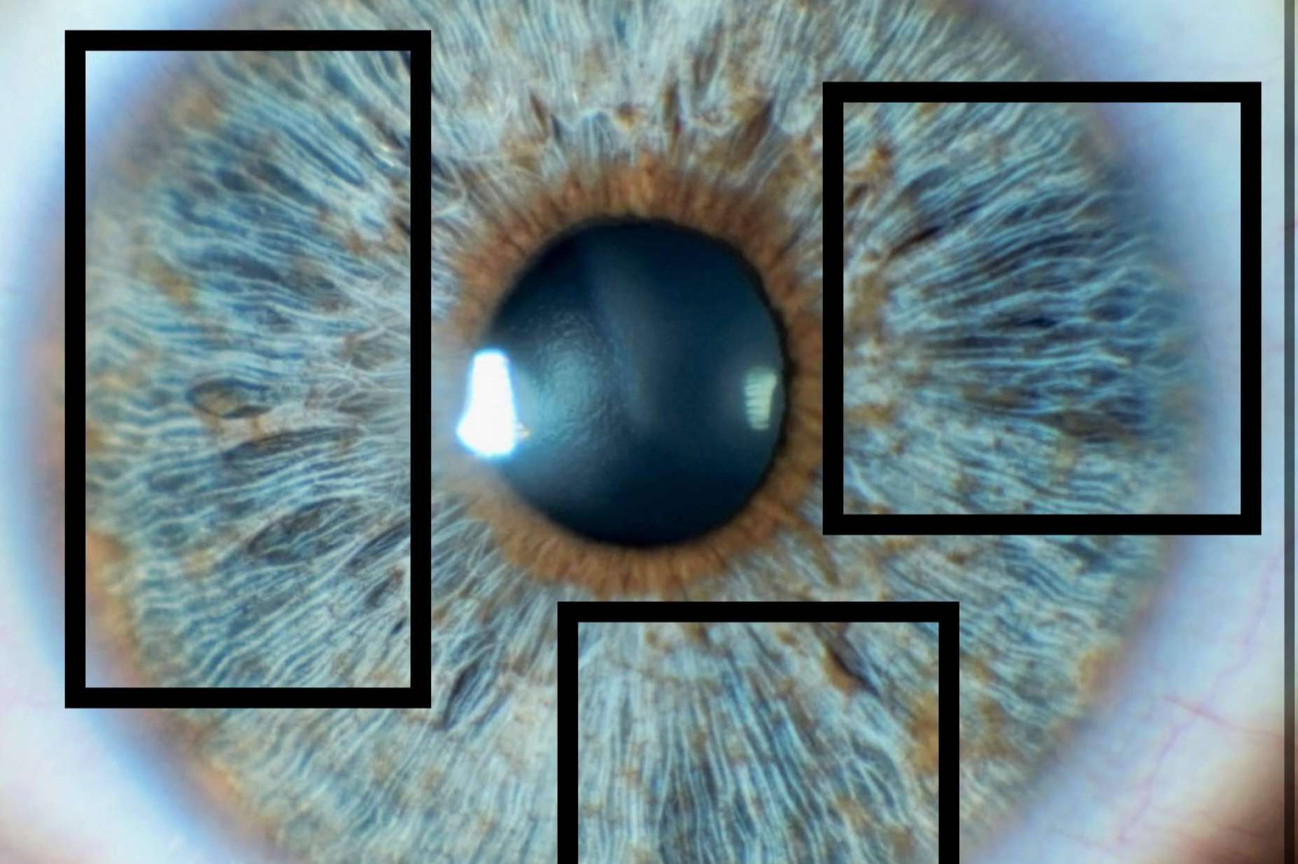 Cómo afecta al brillo de los ojos el colágeno del iris
