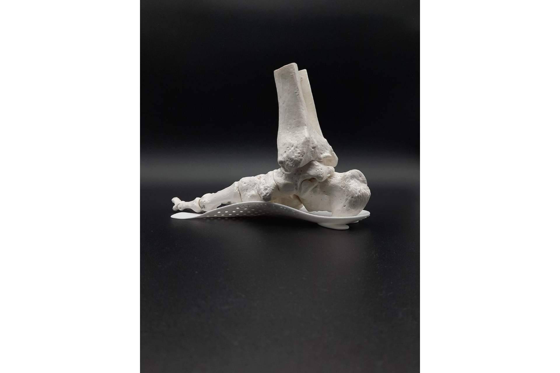 Gracias a la tecnología se puede disfrutar de plantillas diseñadas en 3D, un avance en el campo de la salud