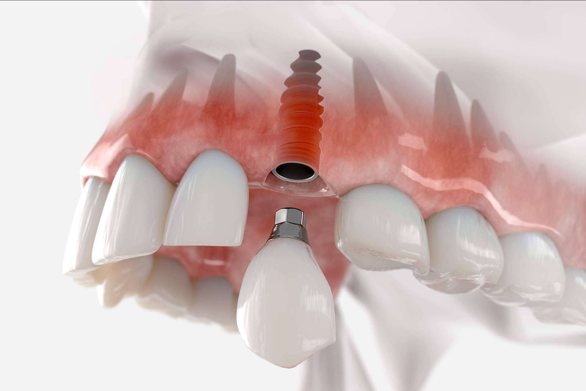 La amplia oferta de servicios odontológicos que ofrece la Clínica Dental Arai