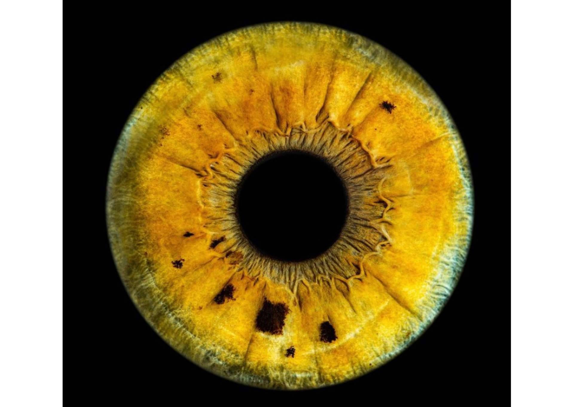 La clínica Eyecos y su software con tecnología puntera para evaluar el color de los ojos