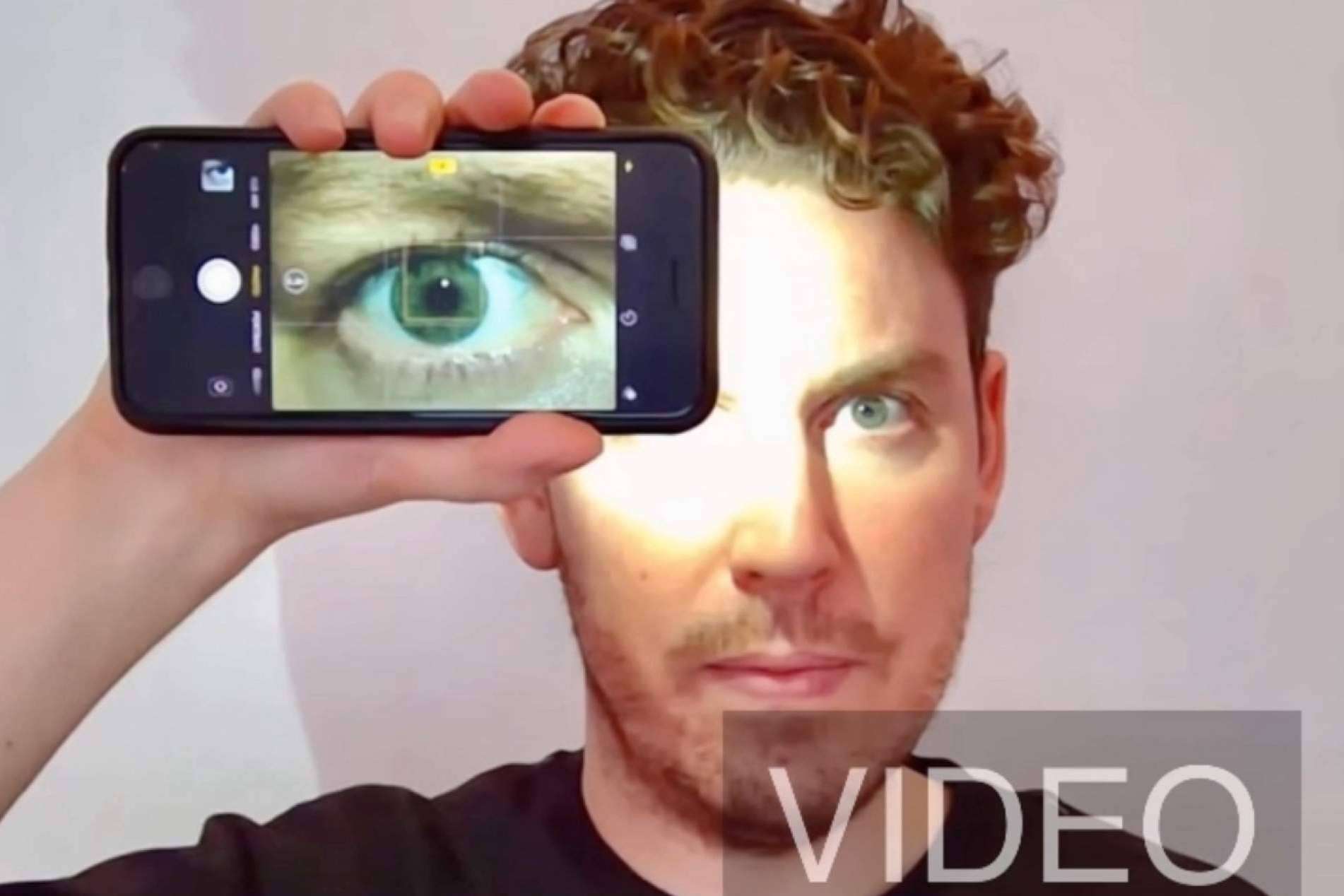 ¿Cómo tomar fotos del iris HD con un smartphone? Clínica Eyecos
