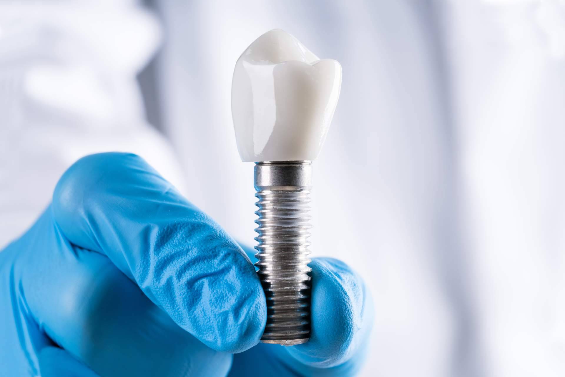 Servicios profesionales de implantología dental en Barcelona, con Clínica Dental Arai