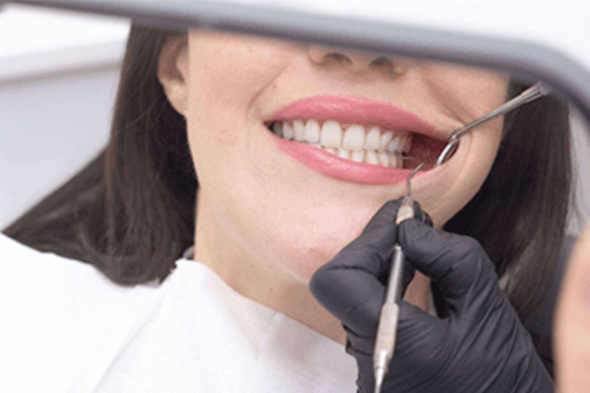 Denty Dent, expertos en tratamientos de estética dental