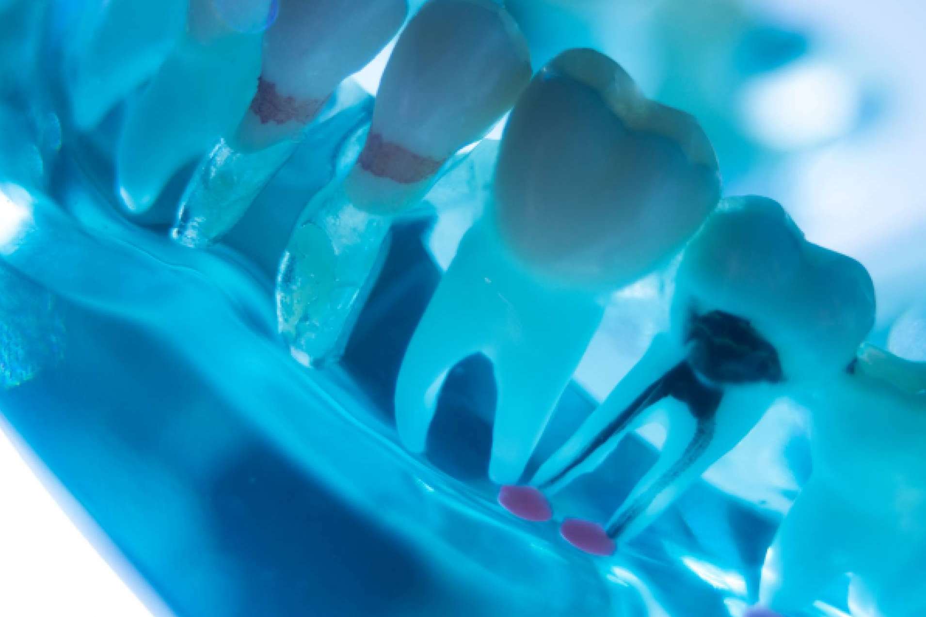 Prevención y tratamiento de enfermedades de las encías, con la clínica Denty Dent