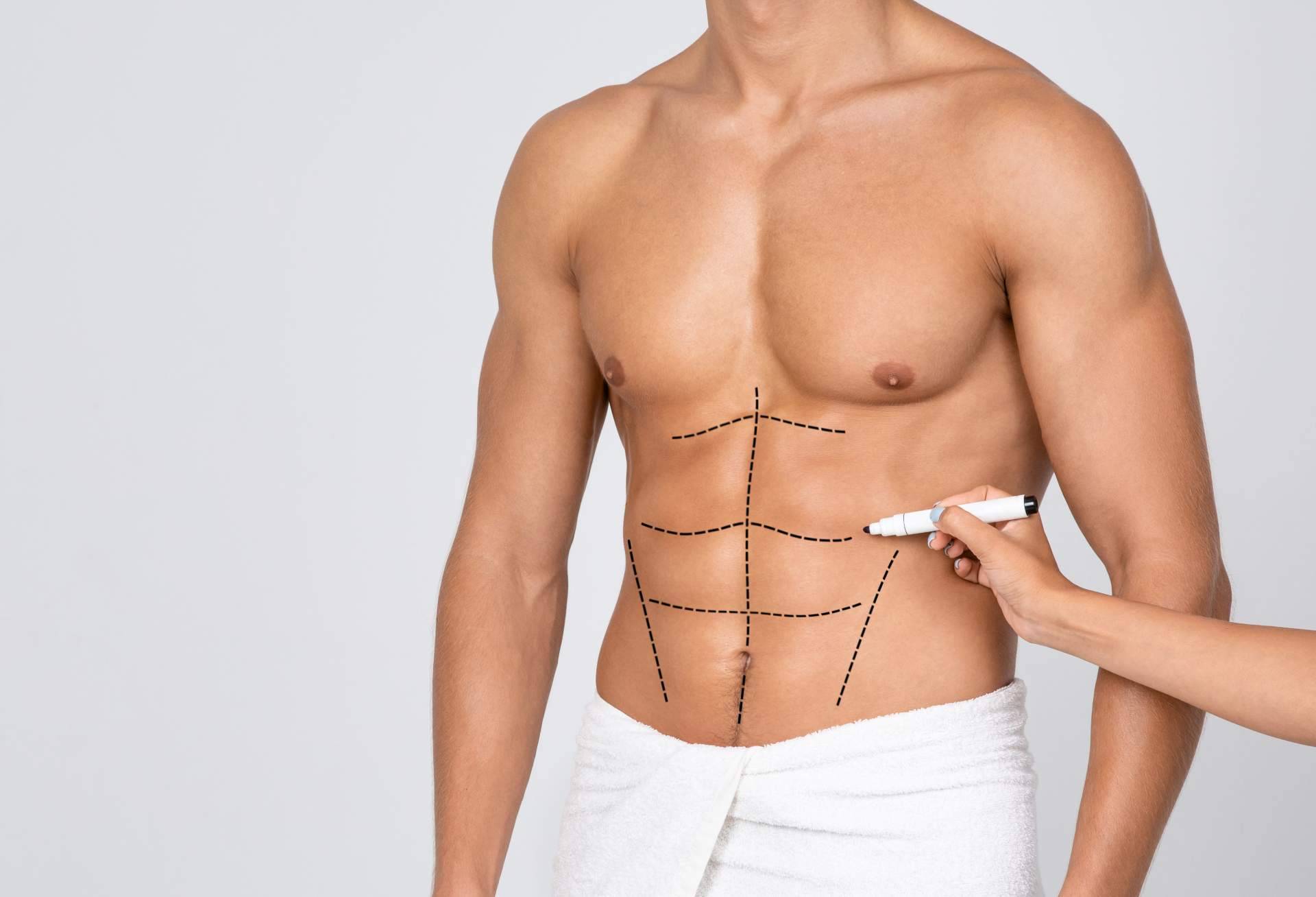 Lipo HD, La clave para un cuerpo atlético y definido