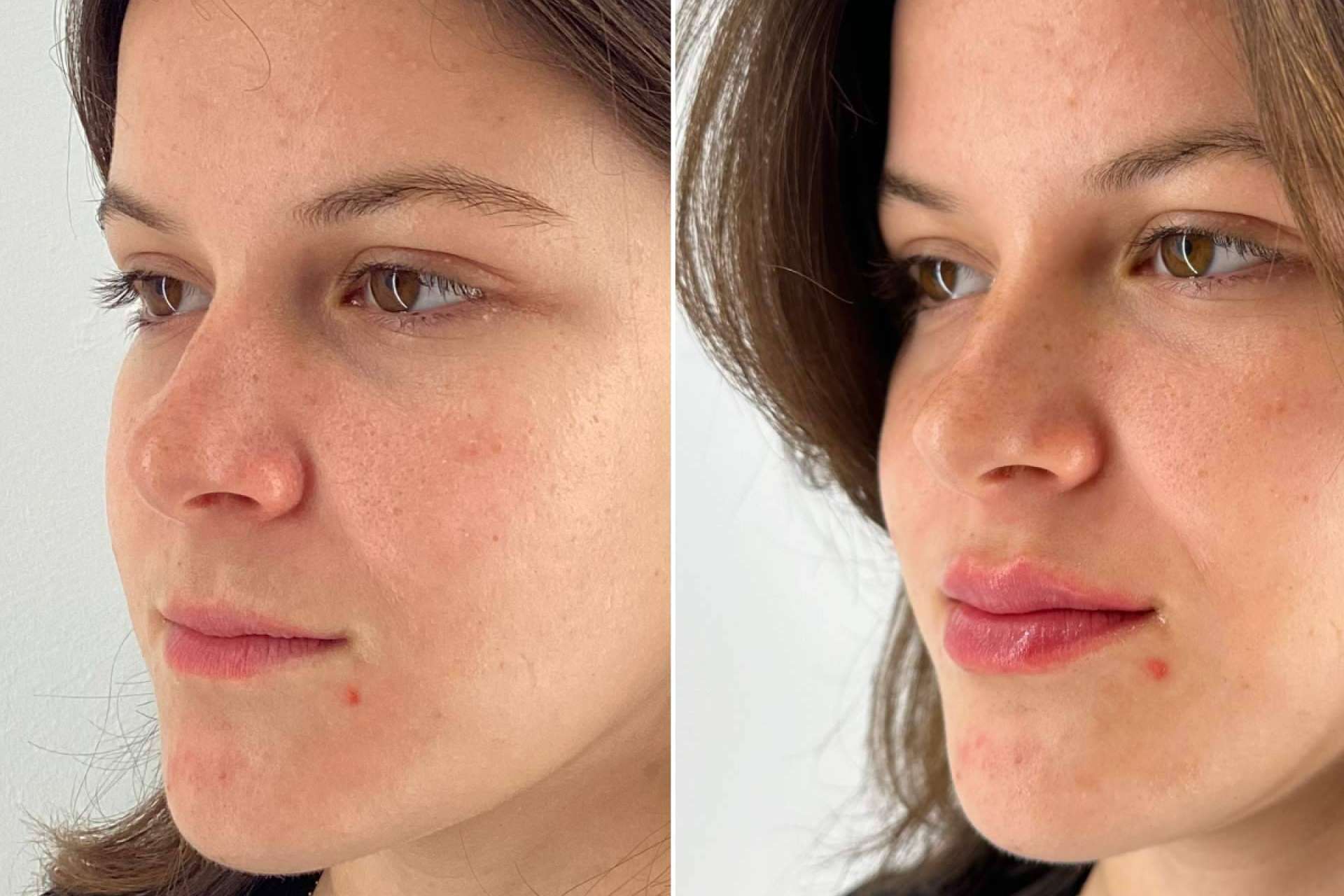 Holaglow presenta Glow Lips, la técnica que redefine el concepto de 'ponerse boca'
