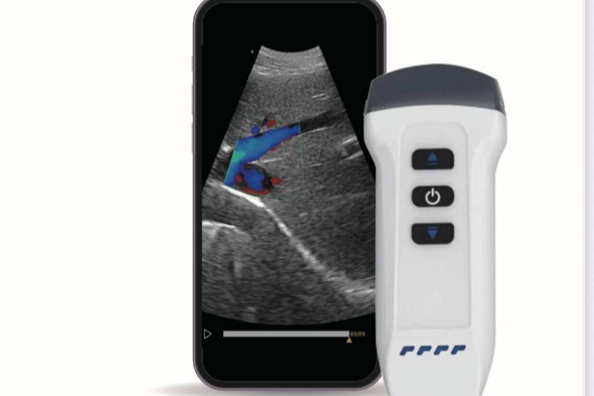 SCPmedical fortalece su catálogo con la línea completa de ecógrafos inalámbricos y portátiles Dawei