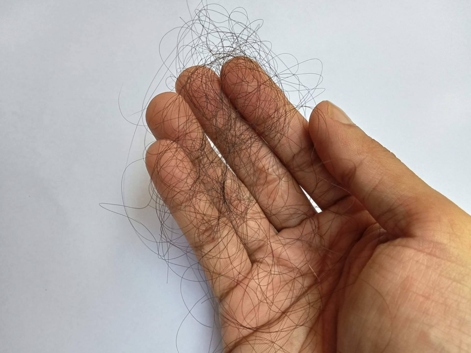 Estrés y caída de cabello ¿están relacionados?